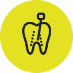 Step 2: the root canals are cleaned and shaped with a fine file